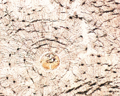 Ground section of bone