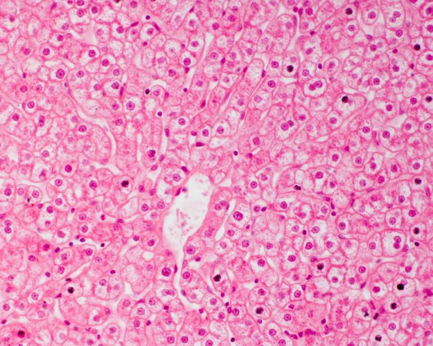 Silver stained liver