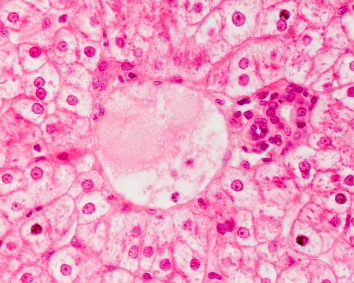 Haematoxillin stained liver