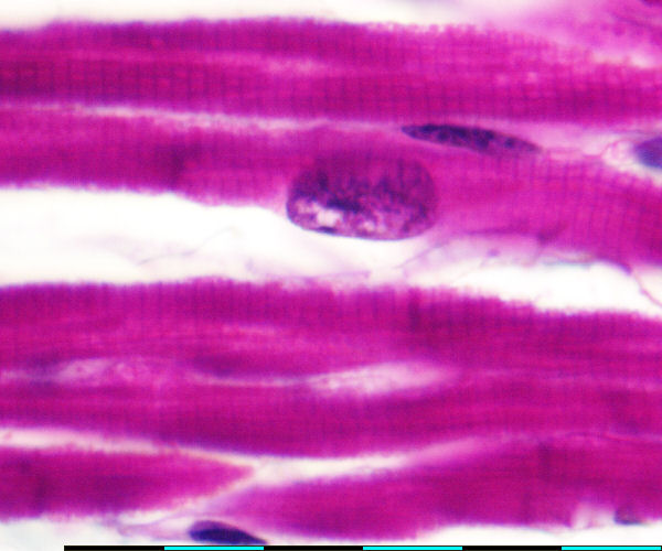 heart muscle fiber