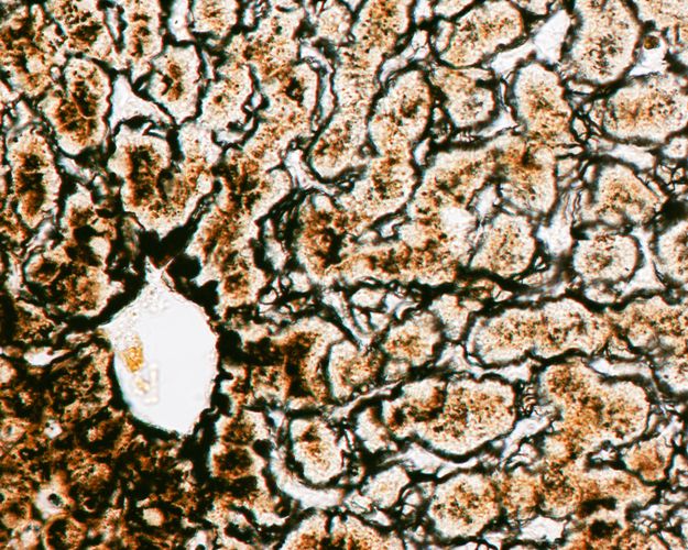 Silver stained liver