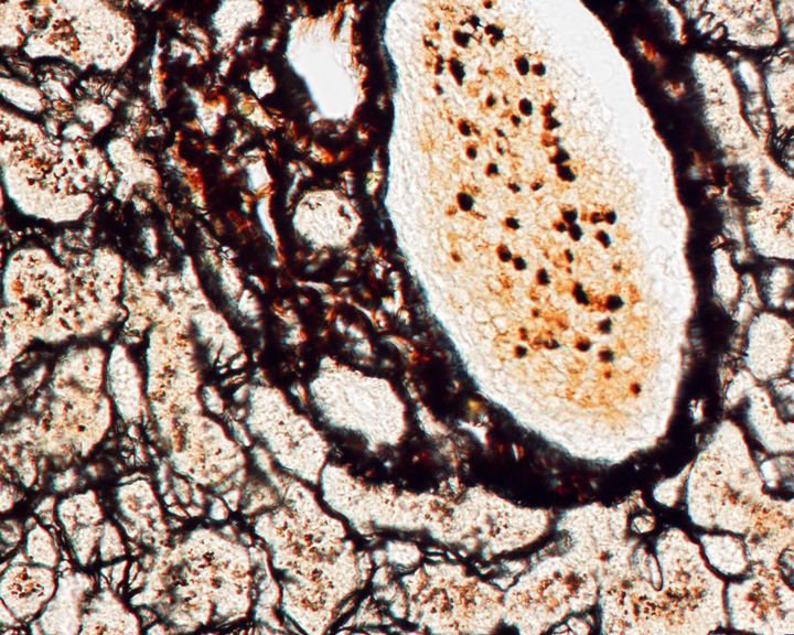 Silver stained liver