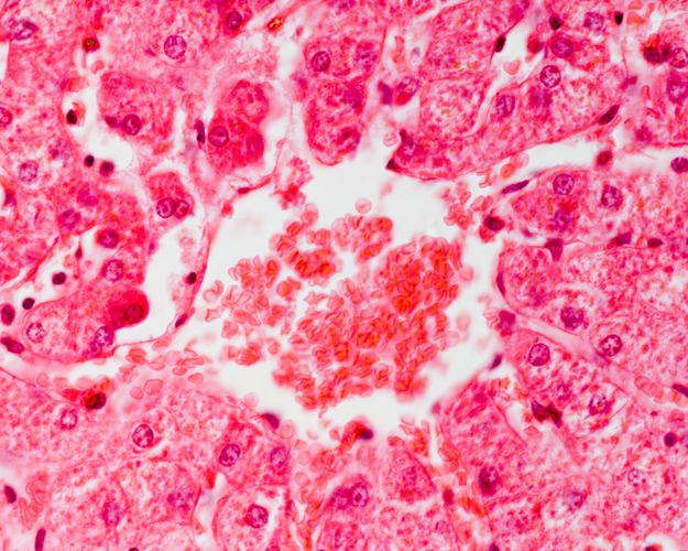 Haematoxillin stained liver