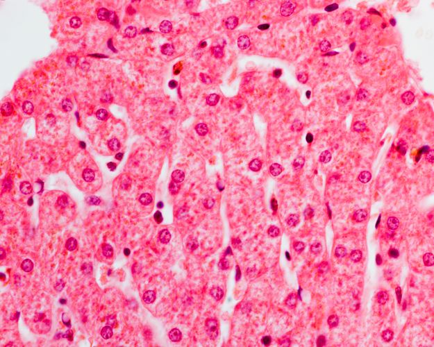 Haematoxillin stained liver